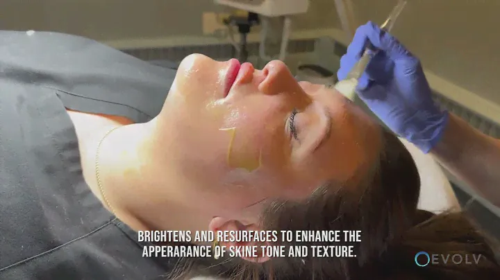 Unlock Radiant Skin with our PCA Bright & Even Peel